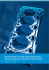 Wielowarstwowe uszczelki stalowe (MLS) głowicy cylindra i Wielowarstwowe uszczelki stalowe (MLS) głowicy cylindra i