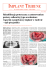 IMPLANT TRIBUNE The World`s Implant New spa per · Po lish Edi tion